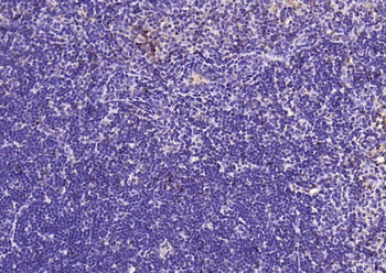 IL33 Rabbit Polyclonal Antibody