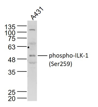 Phospho-ILK-1 (Ser259) Rabbit Polyclonal Antibody