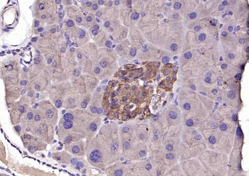 Insulin Rabbit Polyclonal Antibody