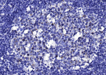 IL-1RA Rabbit Polyclonal Antibody