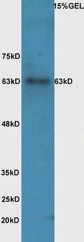 Phospho-IL-1R1 (Tyr496) Rabbit Polyclonal Antibody