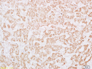 Phospho-IRS1 (Tyr612) Rabbit Polyclonal Antibody