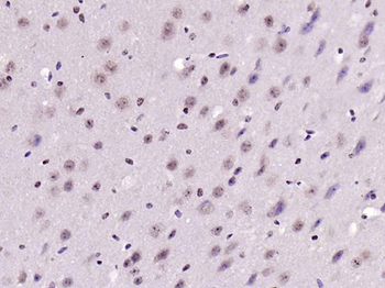 Phospho-IRS1 (Ser636 + Ser639) Rabbit Polyclonal Antibody