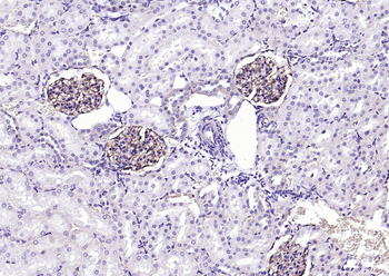 ITGAV Rabbit Polyclonal Antibody