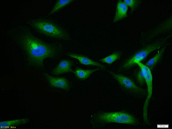 ITGAV Rabbit Polyclonal Antibody