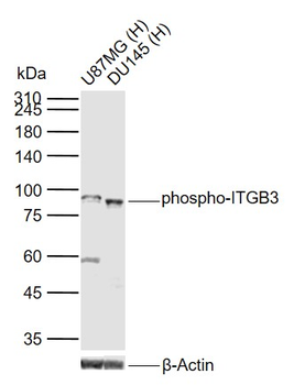 Phospho-ITGB3 (Tyr785) Rabbit Polyclonal Antibody