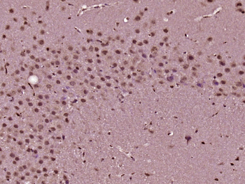 JNK2/MAPK9 Rabbit Polyclonal Antibody