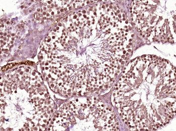 JNK2/MAPK9 Rabbit Polyclonal Antibody