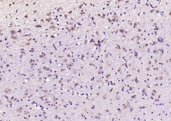 JNK1+JNK2+JNK3 Rabbit Polyclonal Antibody