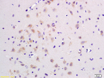 JNK1+JNK2+JNK3 Rabbit Polyclonal Antibody