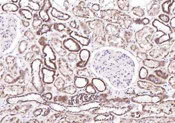 KAT2B Rabbit Polyclonal Antibody