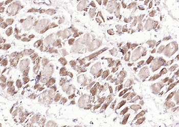 KAT2B Rabbit Polyclonal Antibody