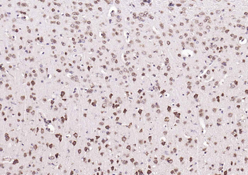 KAT2B Rabbit Polyclonal Antibody