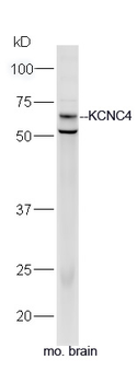 KCNC4 Rabbit Polyclonal Antibody