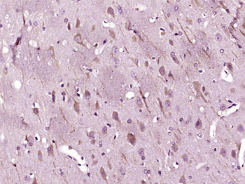 LC3B Rabbit Polyclonal Antibody