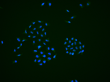 LATS1 Rabbit Polyclonal Antibody
