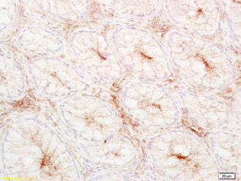 LDL Rabbit Polyclonal Antibody