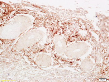 LDL Rabbit Polyclonal Antibody