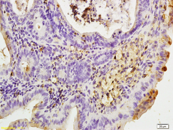 Leptin receptor Rabbit Polyclonal Antibody