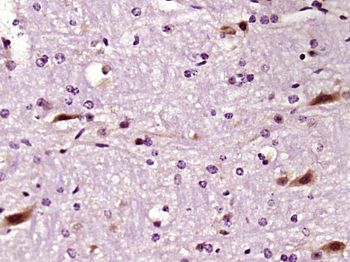 LIMK1 Rabbit Polyclonal Antibody