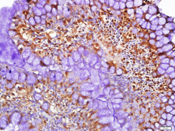 LKB1 Rabbit Polyclonal Antibody