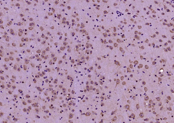 LKB1 Rabbit Polyclonal Antibody