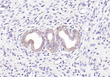 LKB1 Rabbit Polyclonal Antibody