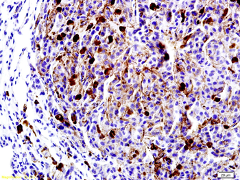 LRP1 Rabbit Polyclonal Antibody