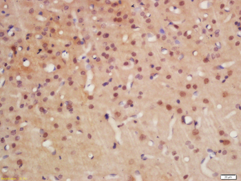 Lyn Rabbit Polyclonal Antibody