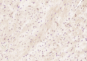 LYK5 Rabbit Polyclonal Antibody