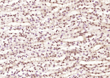 LYK5 Rabbit Polyclonal Antibody