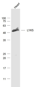 LYK5 Rabbit Polyclonal Antibody