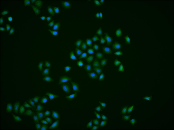 CRTC1 Rabbit Polyclonal Antibody