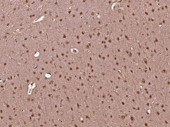 CRTC1 Rabbit Polyclonal Antibody