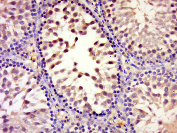 Phospho-MAP4K4 (Ser801) Rabbit Polyclonal Antibody