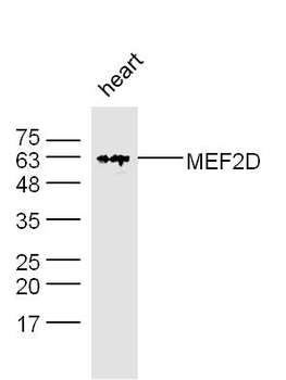 MEF2D Rabbit Polyclonal Antibody