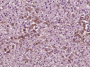 MLK3 Rabbit Polyclonal Antibody
