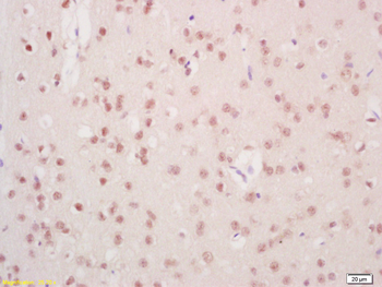 Mre11 Rabbit Polyclonal Antibody