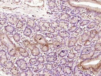 MSH6 Rabbit Polyclonal Antibody