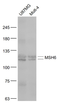 MSH6 Rabbit Polyclonal Antibody