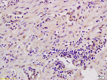 MSK1 Rabbit Polyclonal Antibody