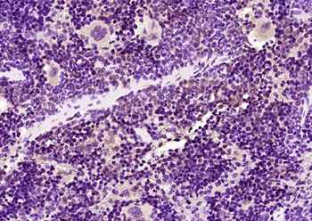 GTPBP3 Rabbit Polyclonal Antibody