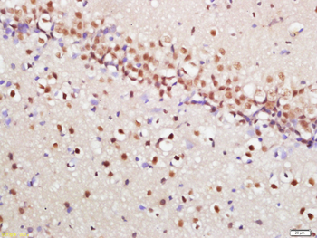 Phospho-mTOR (Ser2448) Rabbit Polyclonal Antibody
