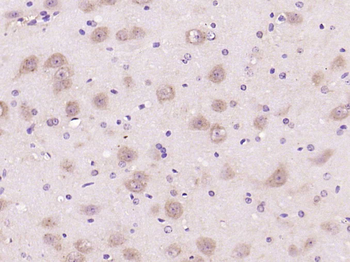 Phospho-mTOR (Ser2481) Rabbit Polyclonal Antibody