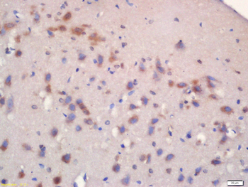 Phospho-mTOR (Ser2481) Rabbit Polyclonal Antibody