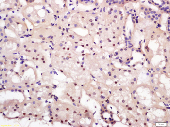 NEDD4-2 Rabbit Polyclonal Antibody