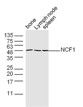 NCF1 Rabbit Polyclonal Antibody