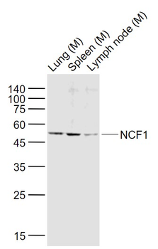 NCF1 Rabbit Polyclonal Antibody