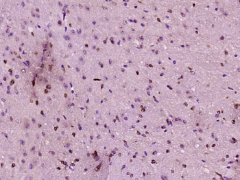 Neurogenin 2 Rabbit Polyclonal Antibody