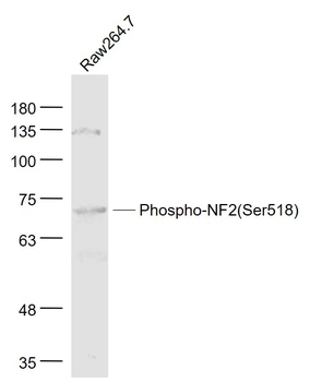 Phospho-NF2 (Ser518) Rabbit Polyclonal Antibody
